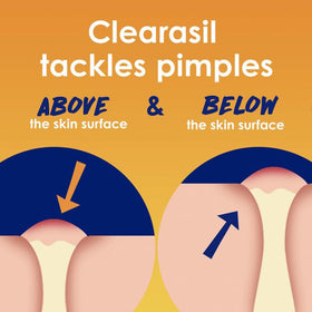 Clearasil salicylic acid graphic showing 2% active ingredient benefit