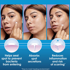 Clearasil patch applied on cheek demonstrating discreet coverage and protection