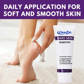 Clearzal being applied to heel, shows targeted treatment for calluses