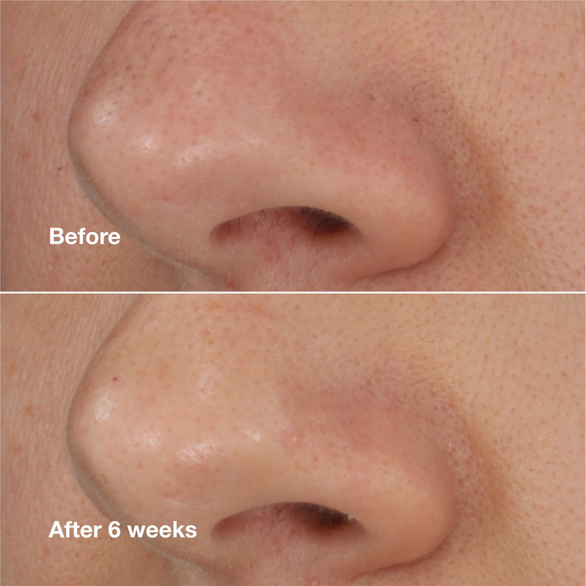 Clinique ingredient close-up showing salicylic acid and powders for exfoliation