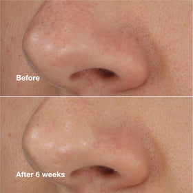 Clinique ingredient close-up showing salicylic acid and powders for exfoliation