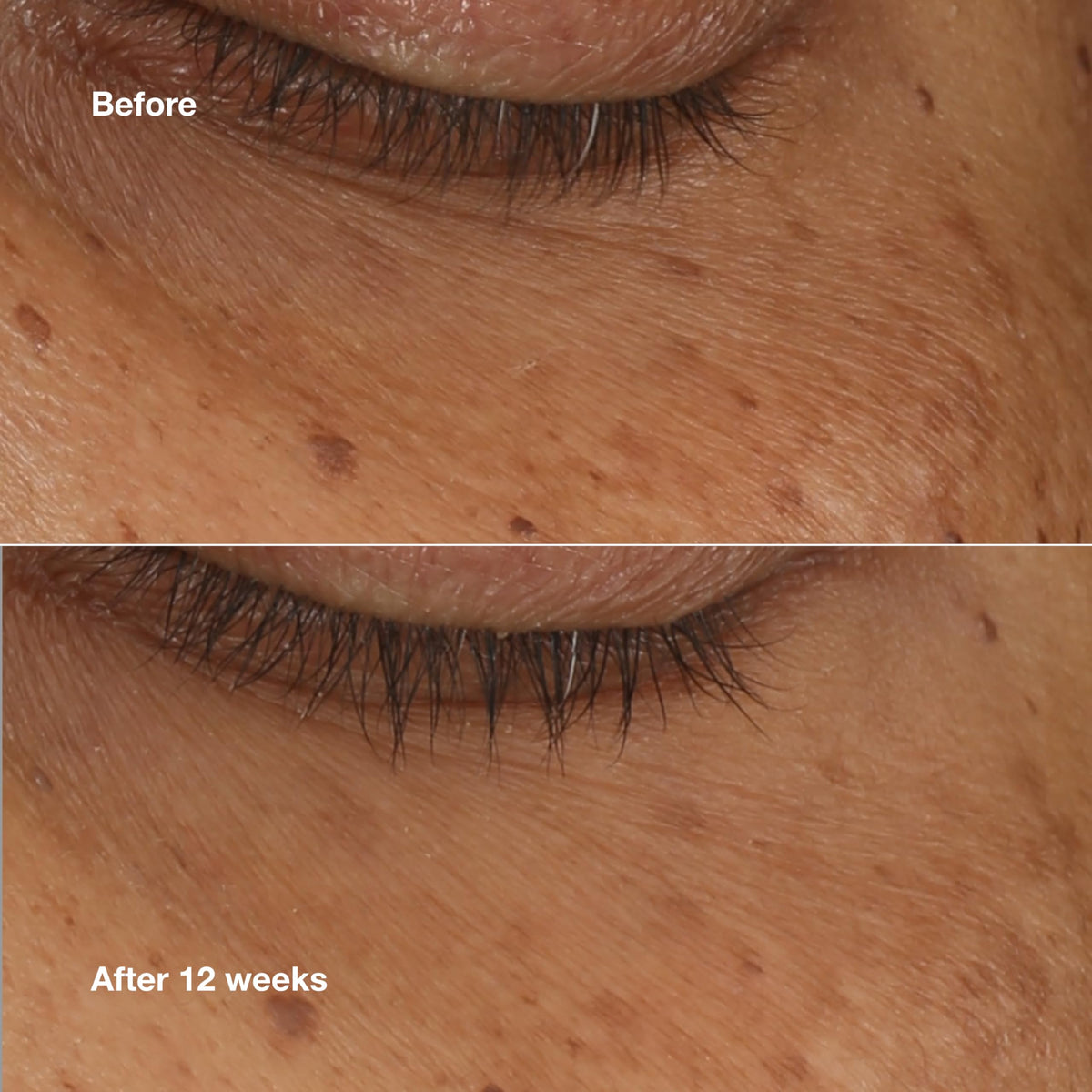 Clinique applying serum under eye demonstrating targeted coverage and ease