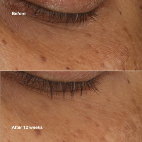 Clinique applying serum under eye demonstrating targeted coverage and ease