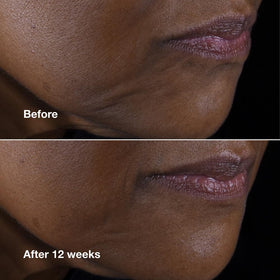 Clinique cream on fingertips demonstrating easy absorption and hydration