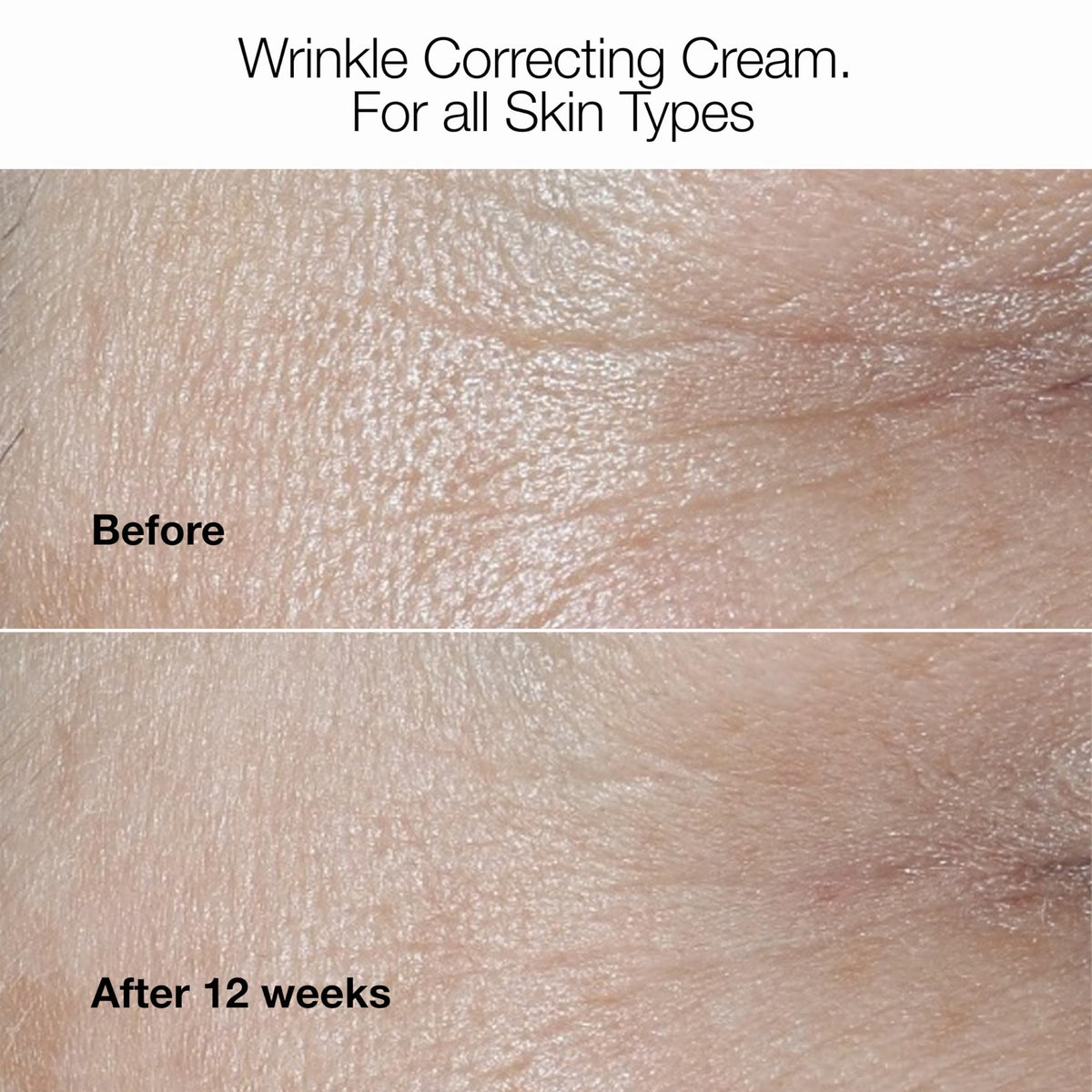 Clinique cream in hand demonstrating 1.7 oz scale and easy daily use benefit