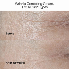 Clinique cream in hand demonstrating 1.7 oz scale and easy daily use benefit