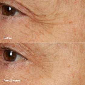 Clinique smoothing product onto neck, supports barrier strengthening and comfort