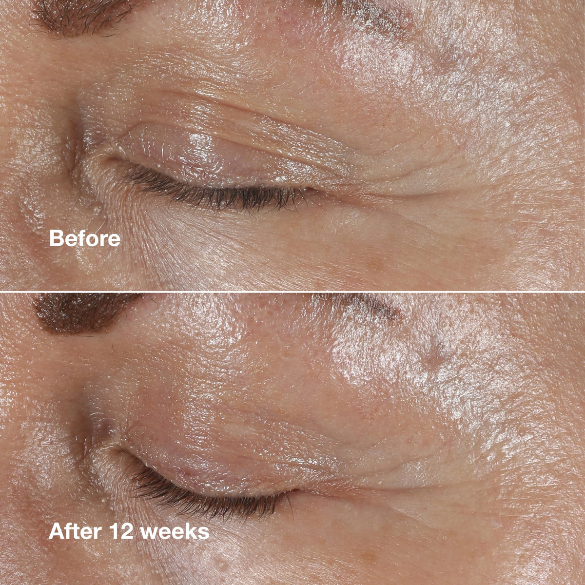 Clinique ingredients display highlighting peptides and hyaluronic benefit