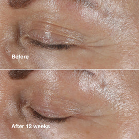 Clinique ingredients display highlighting peptides and hyaluronic benefit