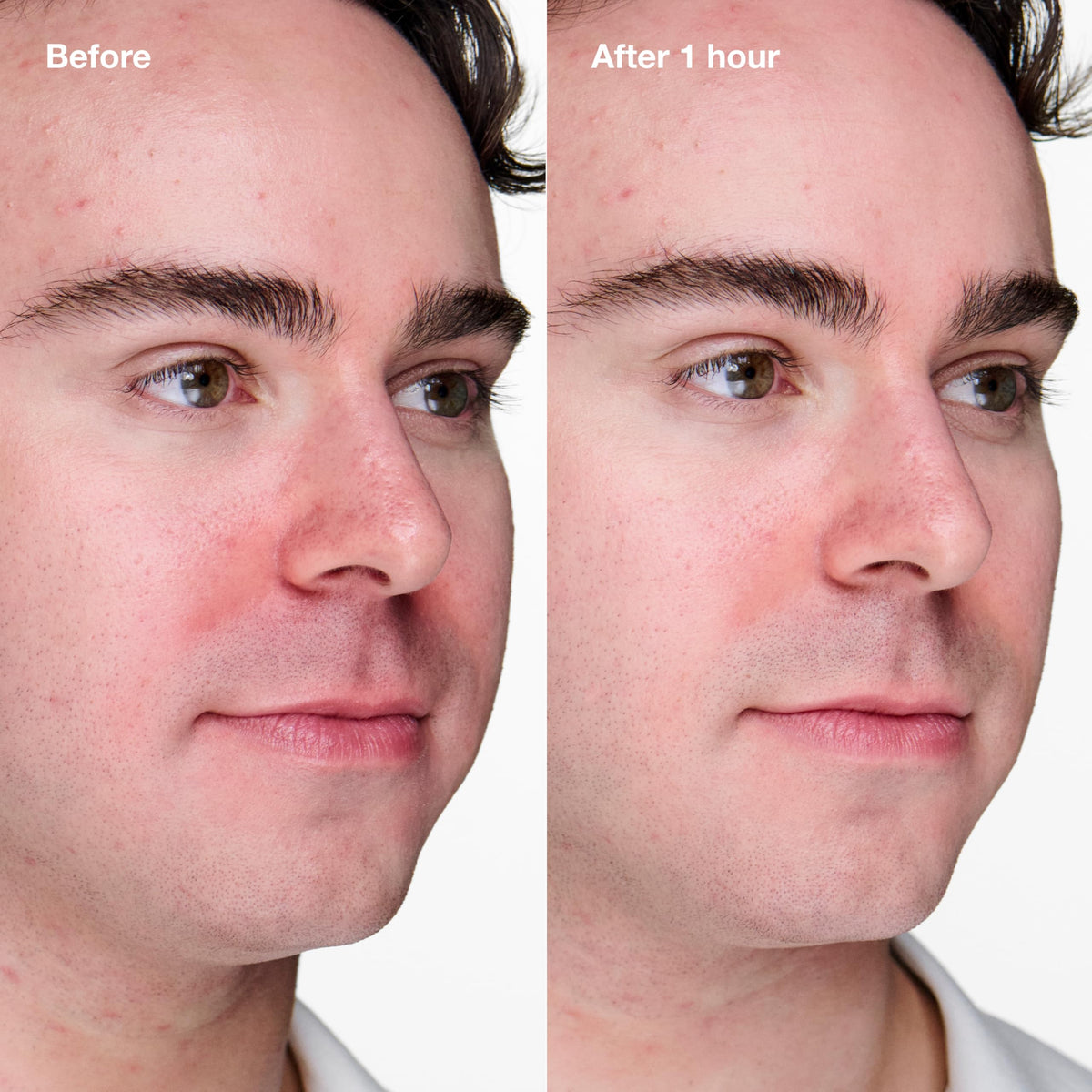 Clinique gel texture closeup showing clear hydro-gel consistency for fast drying