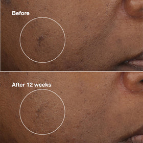 Clinique ingredient callout featuring vitamin C and salicylic acid visuals highlighting brightening and gentle exfoliation benefits