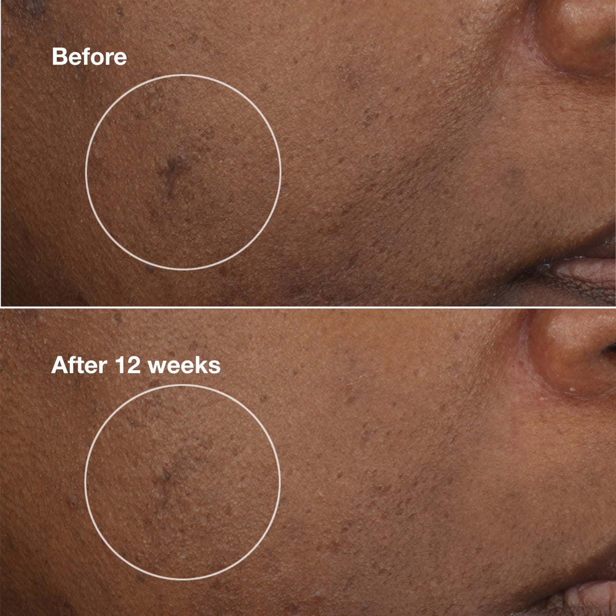 Clinique label detail close-up, highlights active brightening ingredients and science