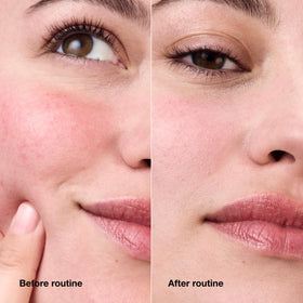 Clinique cream in lifestyle setting showing calm skin appearance benefit