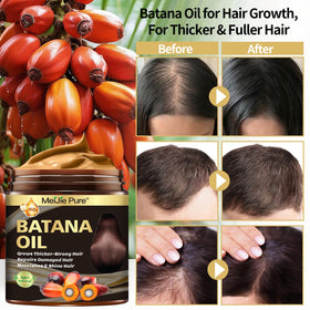 CLOTHES OF SKIN oil pouring into hand for precise scalp nourishment