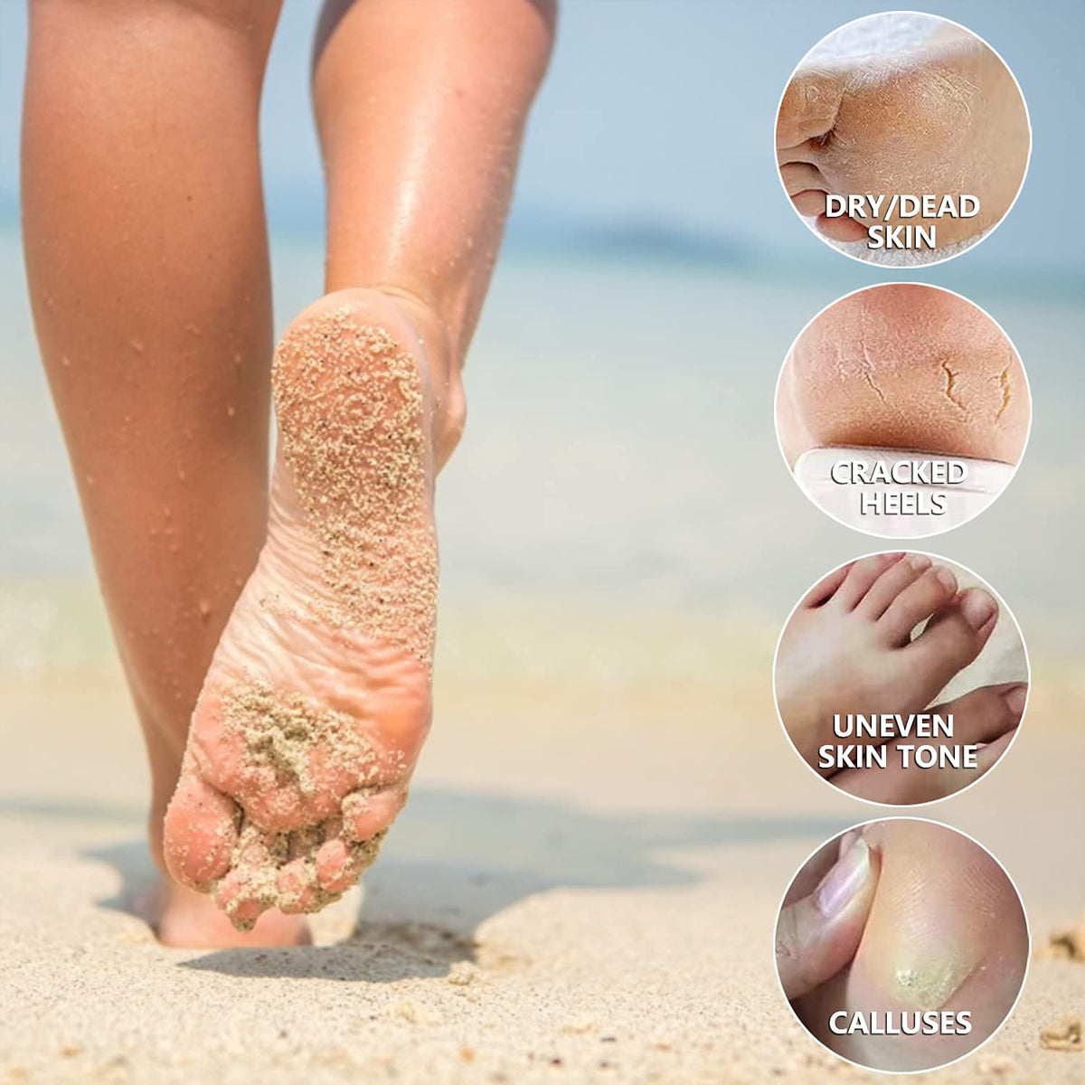 CMWGKBC peeling stage on heels showing visible exfoliation benefit