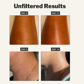 Cocokind stick applied on elbow highlighting targeted hydration and barrier support for dry patches