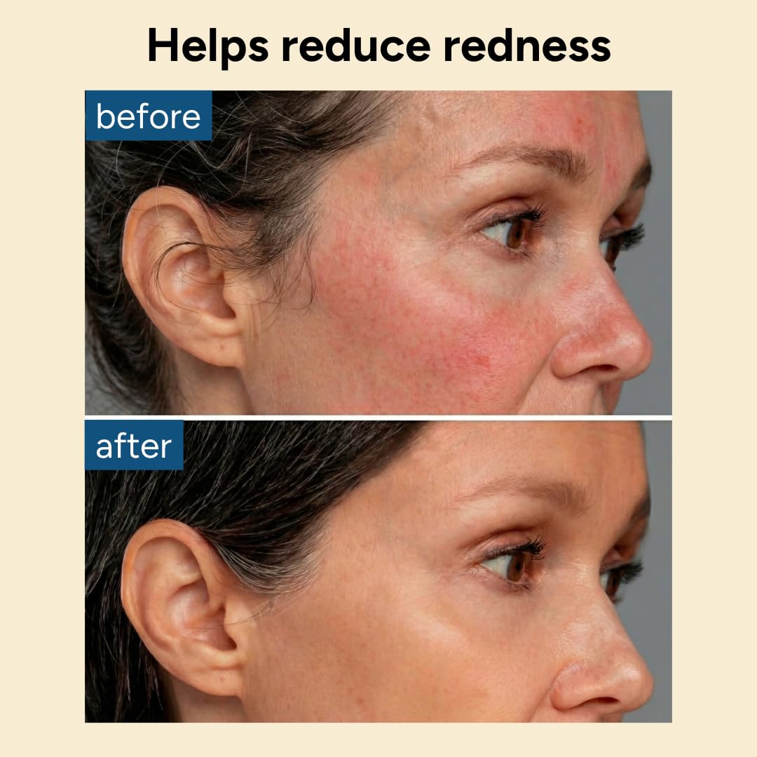 Codi New York hydro soothe used after beach exposure showing calming recovery
