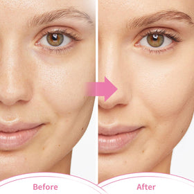 CONBELLA mask in bedside setting highlighting calming nighttime recovery routine