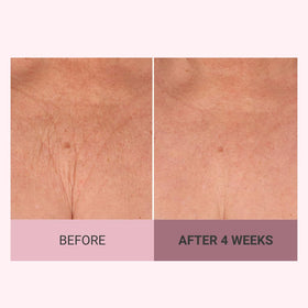 Consult Beaute open jar showing creamy contents for deep moisturizing