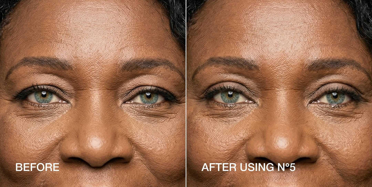Contours Rx strip being applied to eyelid fold demonstrating instant lift benefit