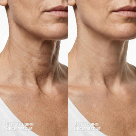 Contours Rx in-use with updo hair hiding strip for invisible results