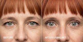 Contours Rx showing makeup layered over strip for seamless cosmetic finish