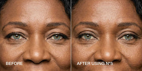 Contours Rx applied under eye with makeup for seamless cosmetic finish