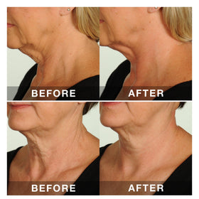 Contours Rx lifestyle evening out demonstrating confidence and photo-ready neck