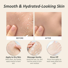 CORACODE use on hands and elbows showing multiuse smoothing effect