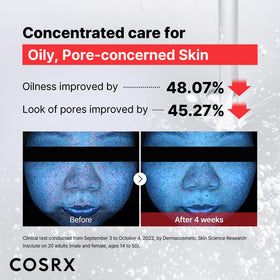 COSRX before and after skin application illustrating smoother texture and reduced pore look