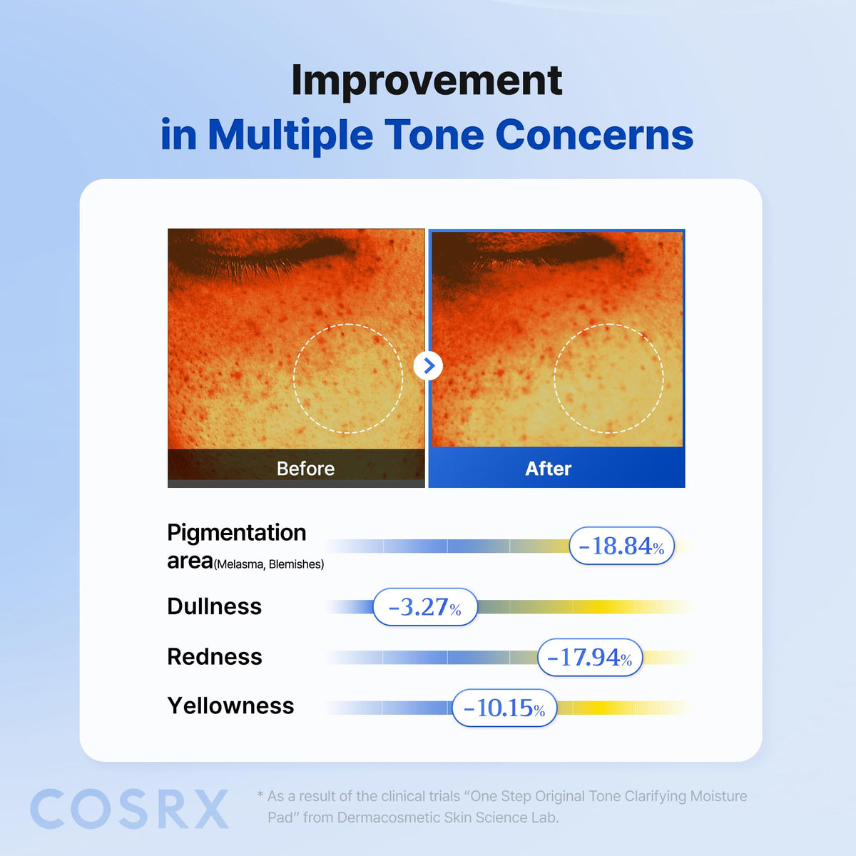 COSRX pad applied under eye showing target hydration and smoothing
