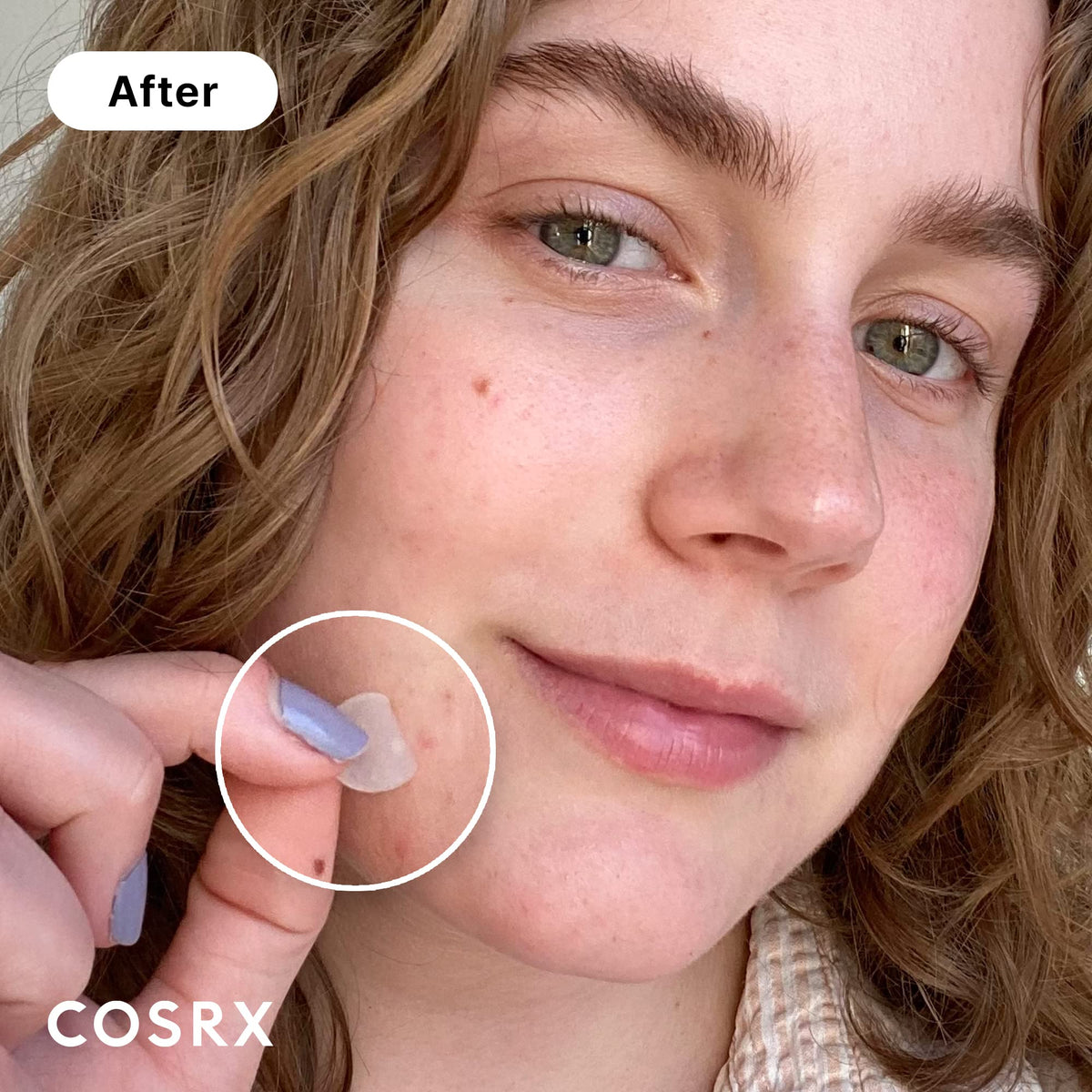 COSRX close-up of hydrocolloid texture showing absorbent surface benefit