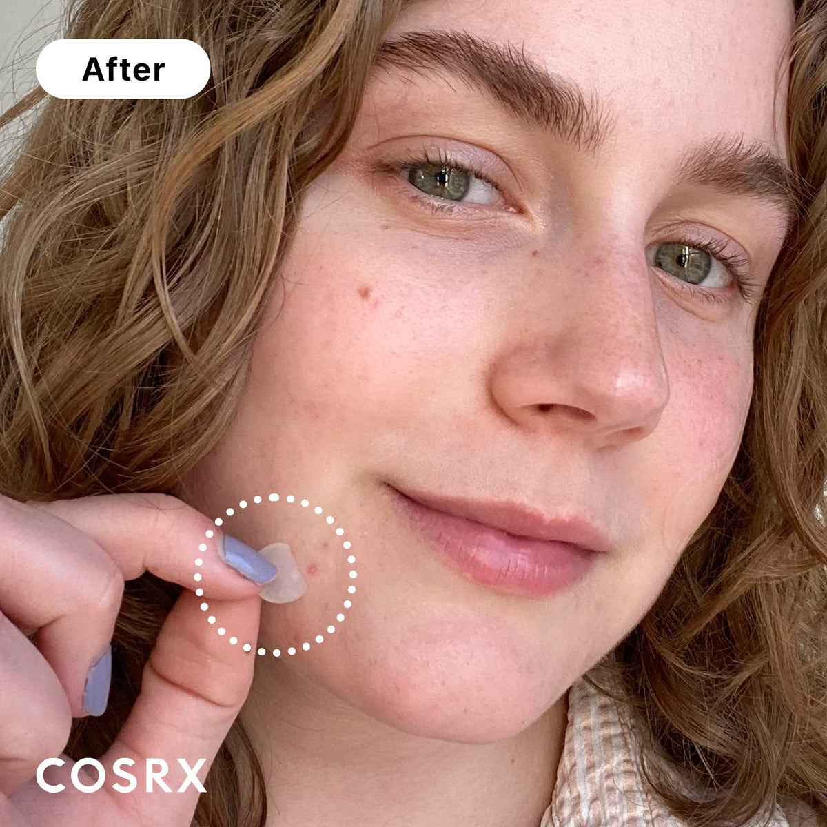 COSRX sheet close-up texture showing hydrocolloid surface and absorption