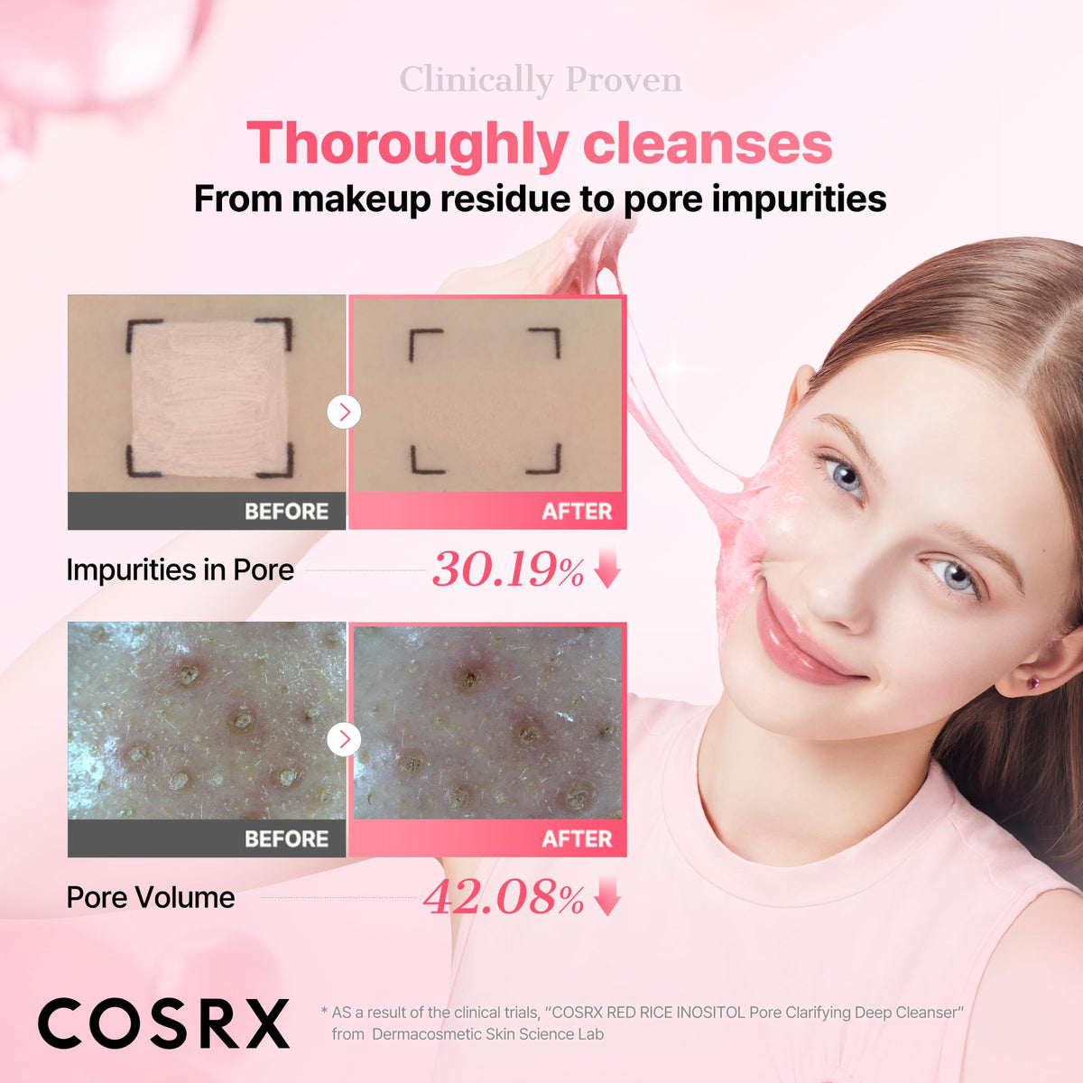 COSRX applied to dry skin as a wash-off mask for pores