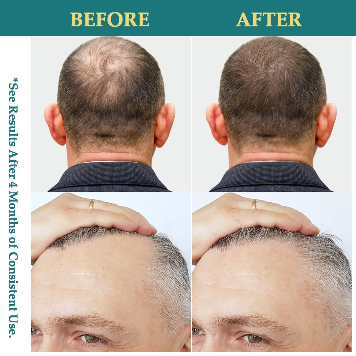 Creip scalp spray applied on curly hair showing improved manageability
