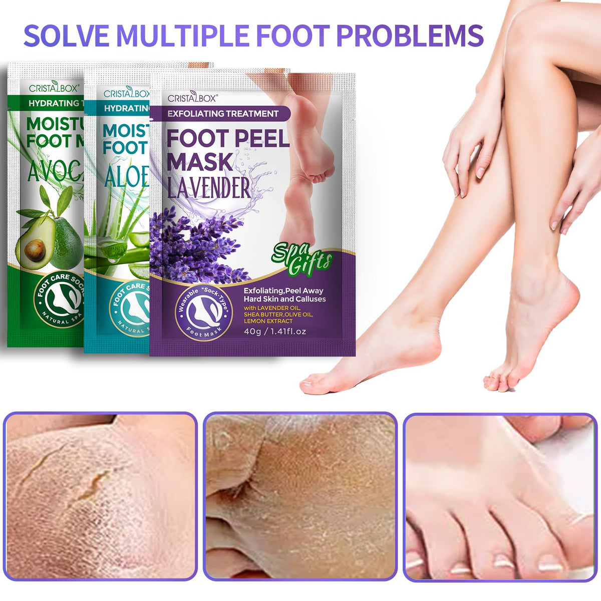 CRISTALBOX before and after feet photo highlighting smoother heels benefit