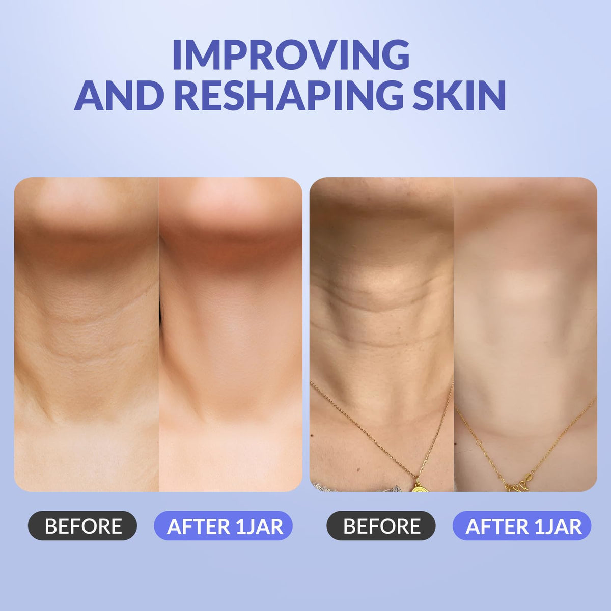 Crogooe neck before and after visual showing improved skin texture