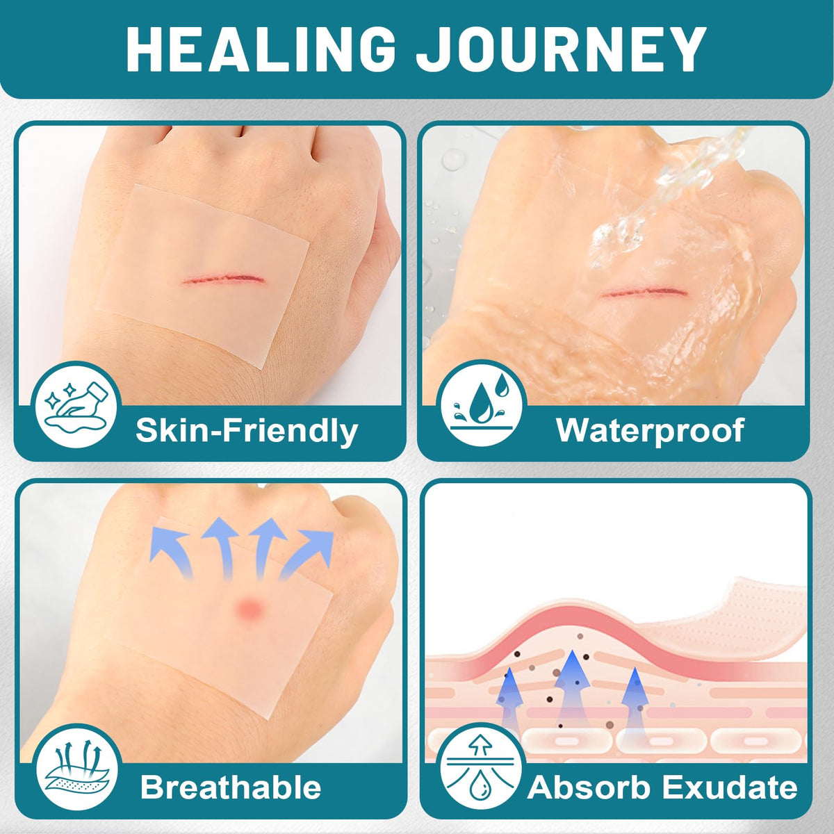 CUKWUYBY dressing applied to elbow illustrating secure joint protection