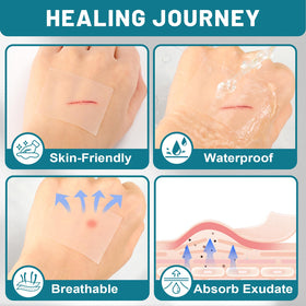 CUKWUYBY dressing applied to elbow illustrating secure joint protection
