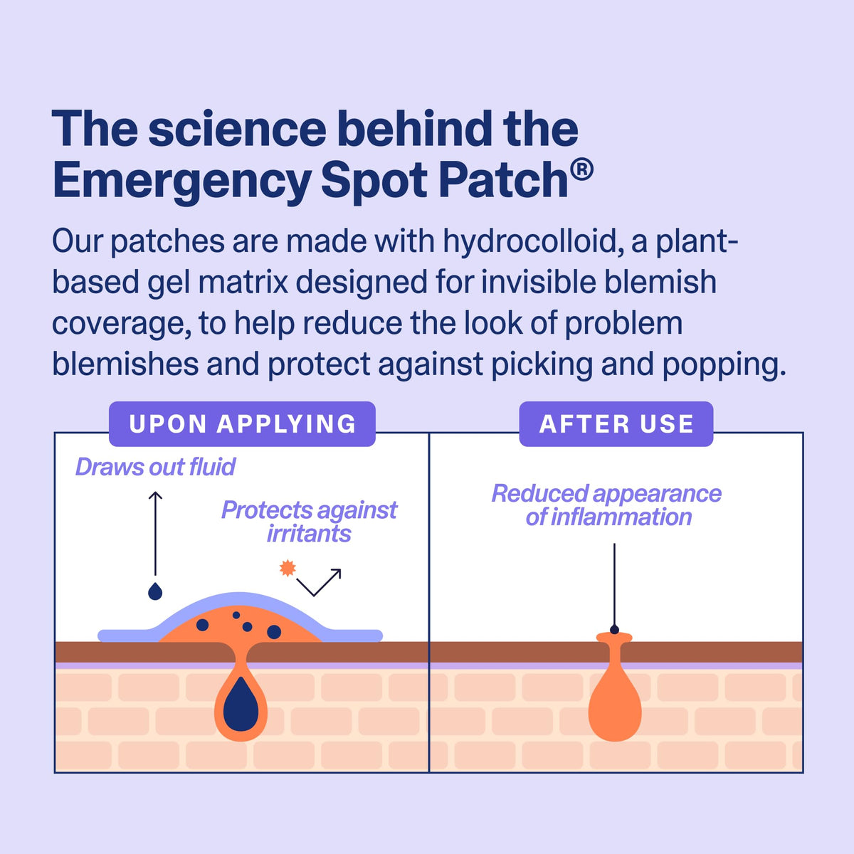 Curology patch under foundation showing concealment benefit