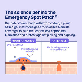 Curology patch under foundation showing concealment benefit