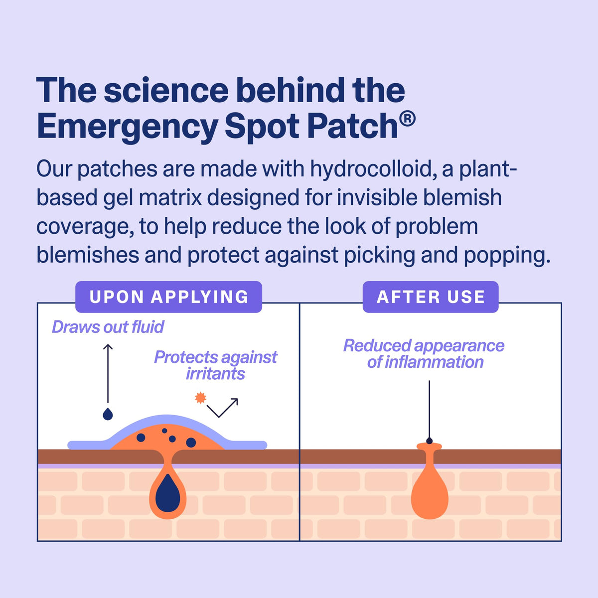 Curology patch under makeup offering discreet coverage and confidence