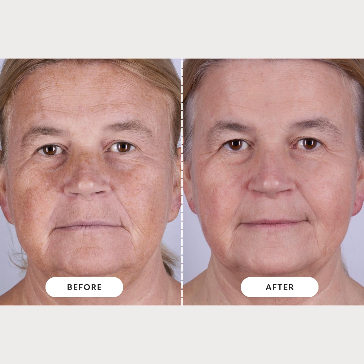 CurrentBody Series 2 in-use on a user relaxing that illustrates easy at-home treatment benefit