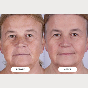 CurrentBody Series 2 in-use on a user relaxing that illustrates easy at-home treatment benefit