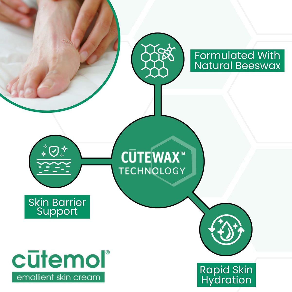 Cutemol used on heel to soften rough skin and restore moisture