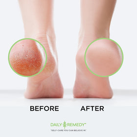 Daily Remedy label with ingredients list showing transparency and formulation