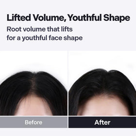 DALEAF before and after volume boost for visible lift
