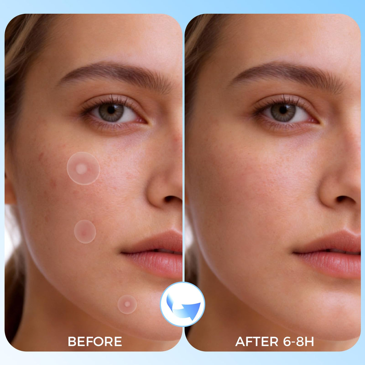 DATISEP patches held in hand to show scale and multiple sizes for targeted blemish coverage