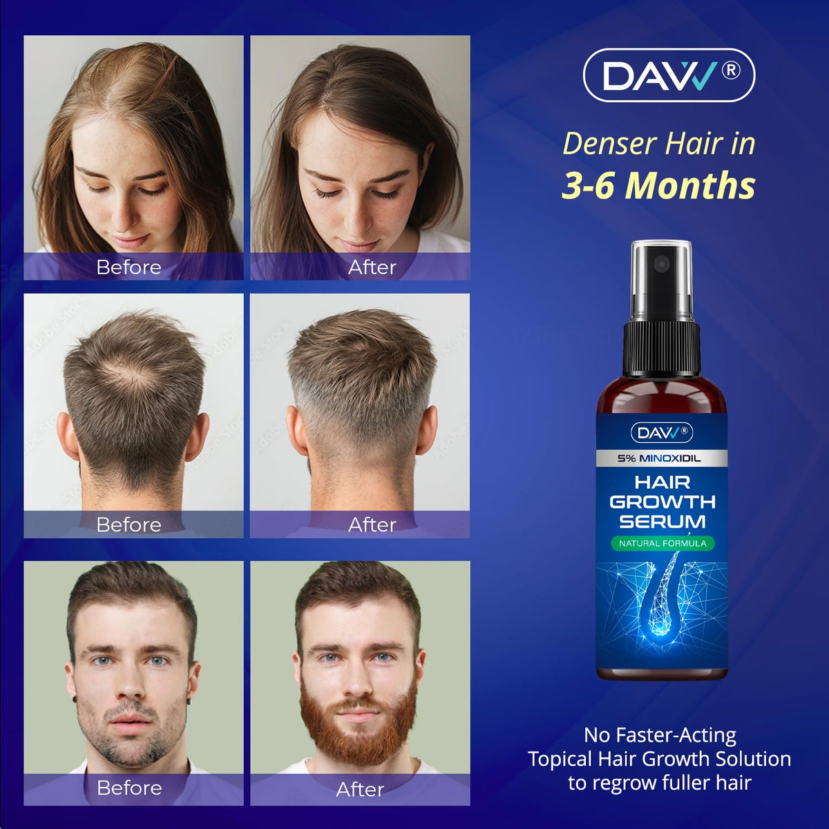 DAVV spray nozzle close-up highlighting even targeted application benefit