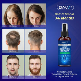 DAVV spray nozzle close-up highlighting even targeted application benefit